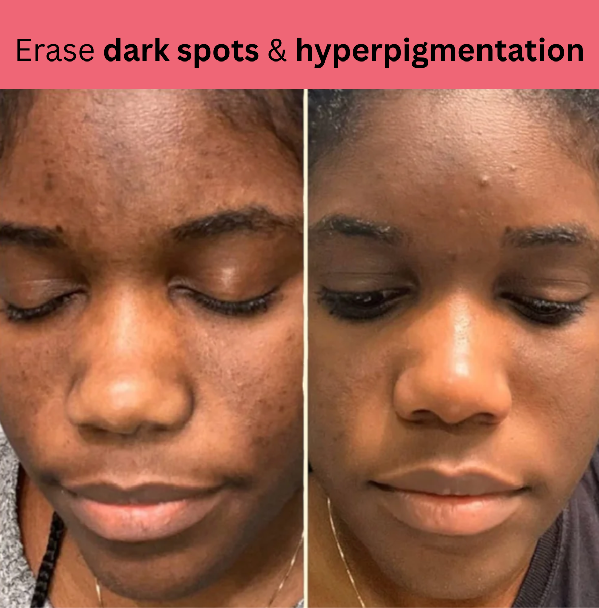 Kojic Acid Turmeric Overnight Mask
