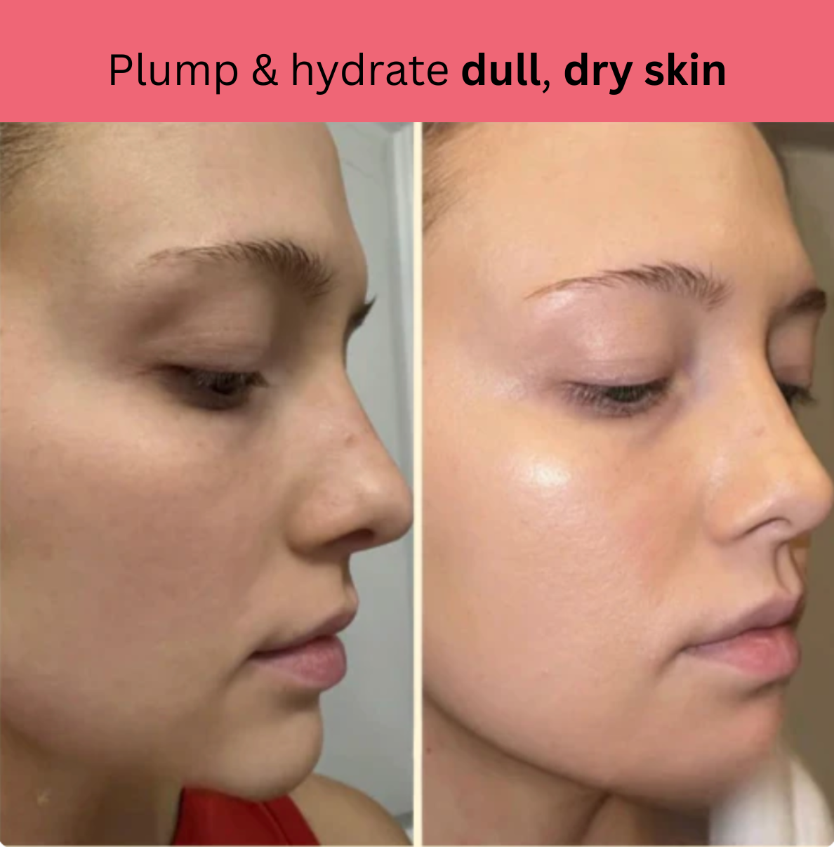 Kojic Acid Turmeric Overnight Mask