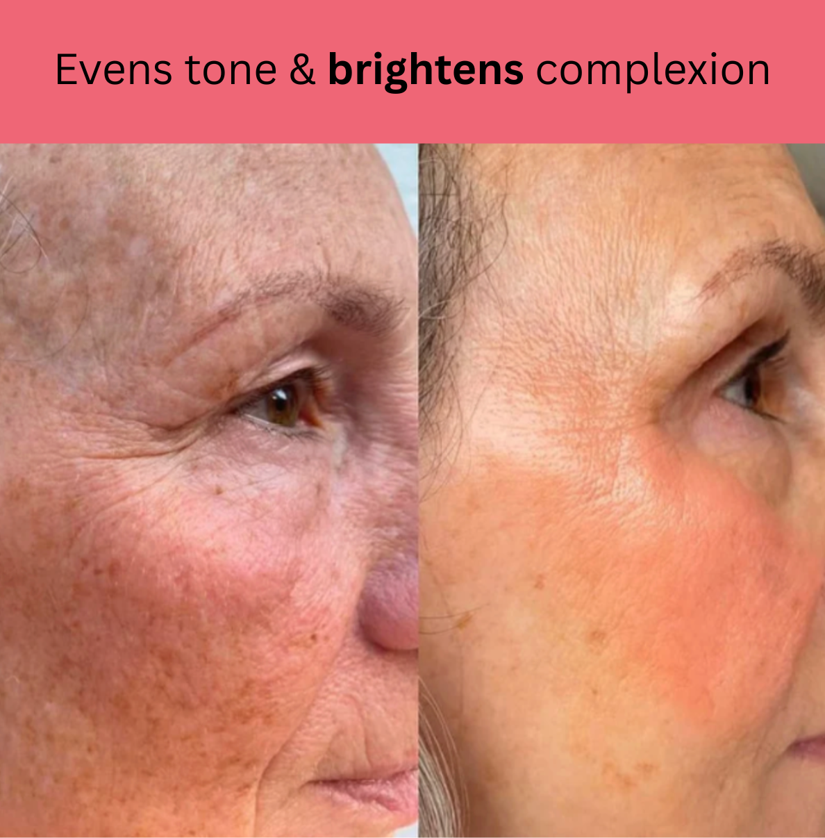 Kojic Acid Turmeric Overnight Mask