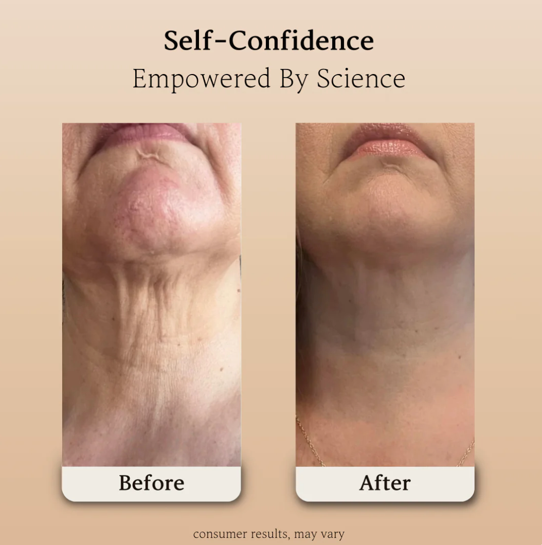 Firm Lifting Neck Cream