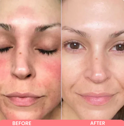 Kojic Acid Turmeric Wrapping mask