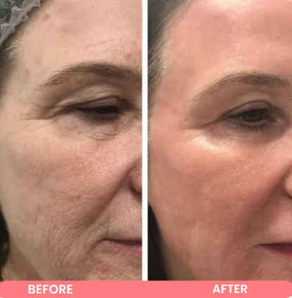 Kojic Acid Turmeric Wrapping mask