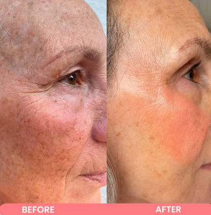 Kojic Acid Turmeric Wrapping mask